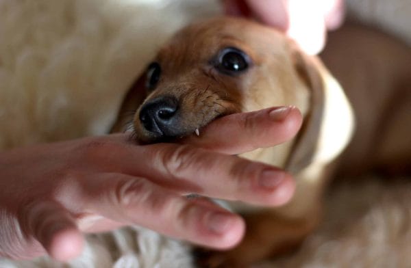 Dog biting a person