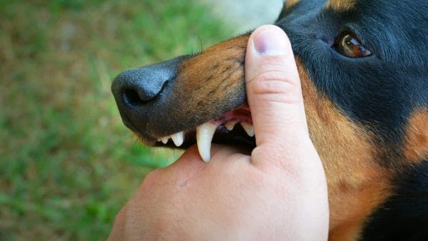 what happens when dog bites human